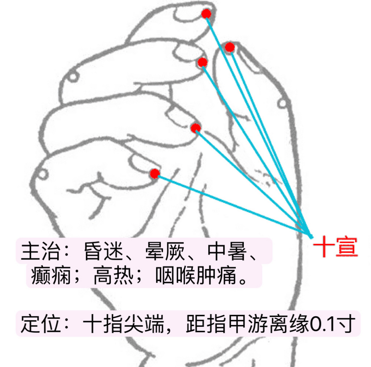 一天记一个穴位—十宣 十宣穴,经外奇穴.