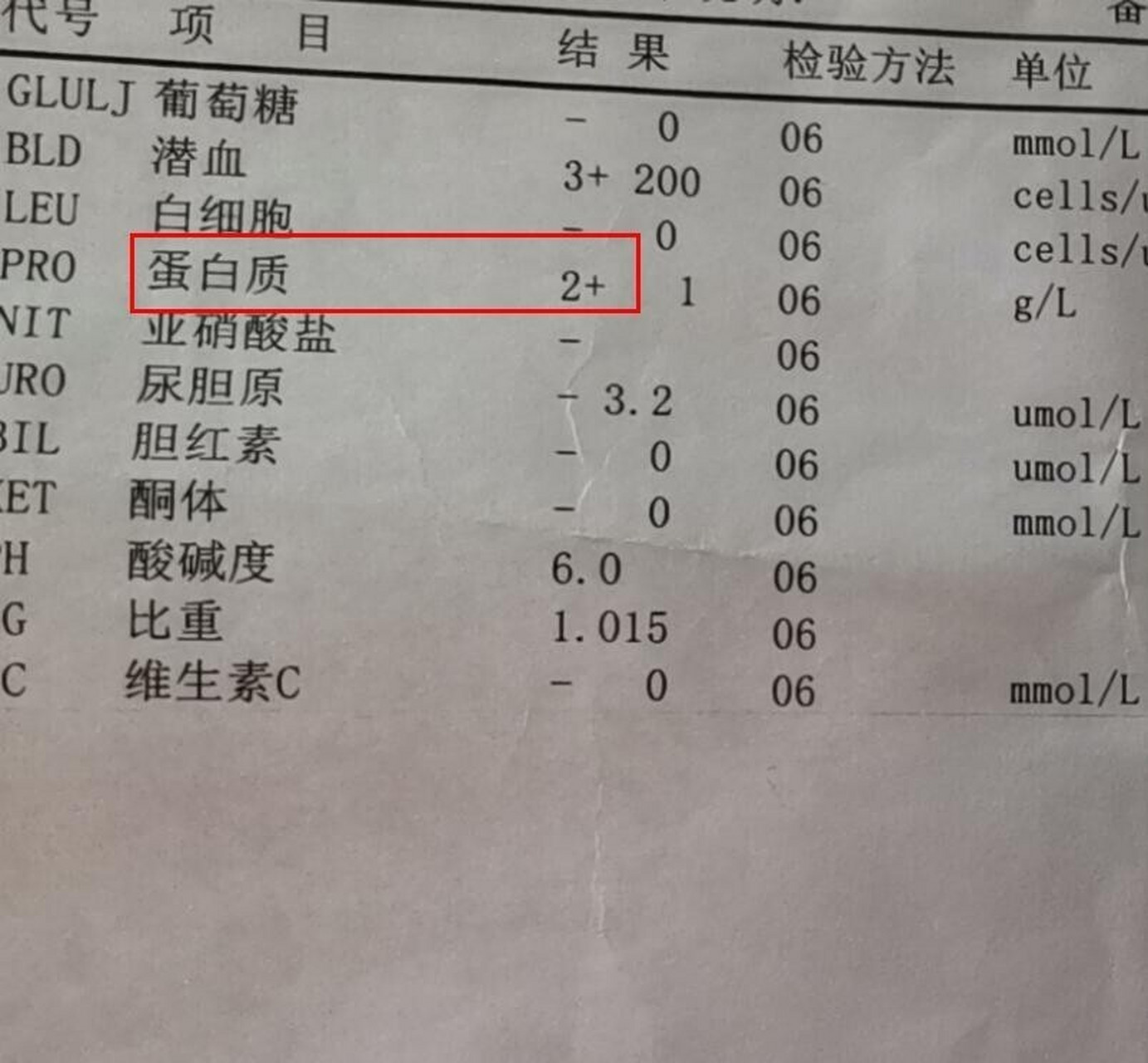 尿蛋白1 ,意味着病情还不是很严重,是可以治疗和控制的 尿蛋白2