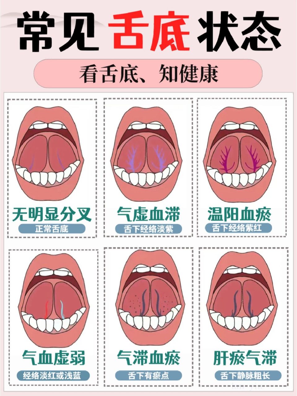 舌头底结构图片