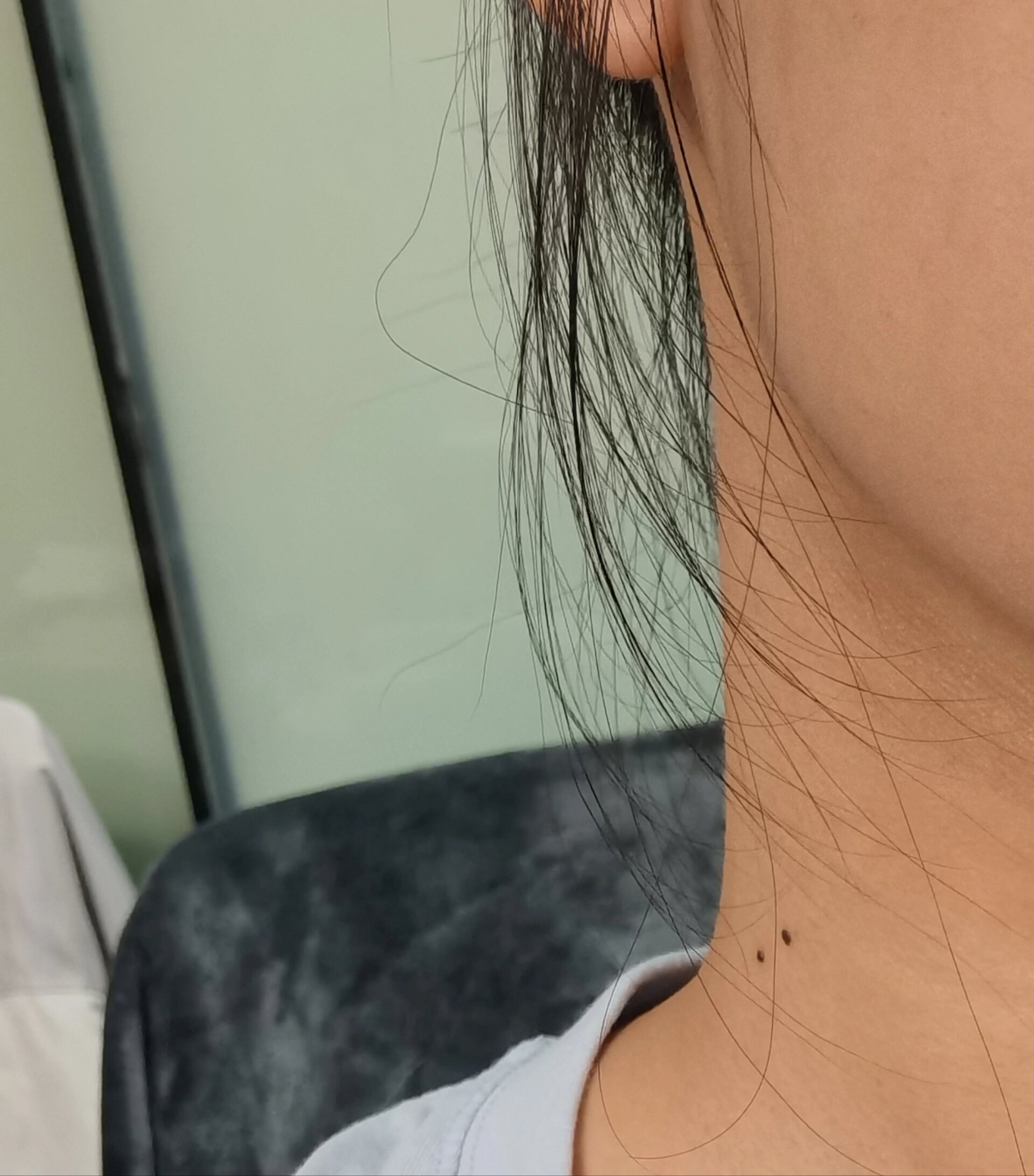 请教脖子右侧有两颗痣别人说是固执要点吗?