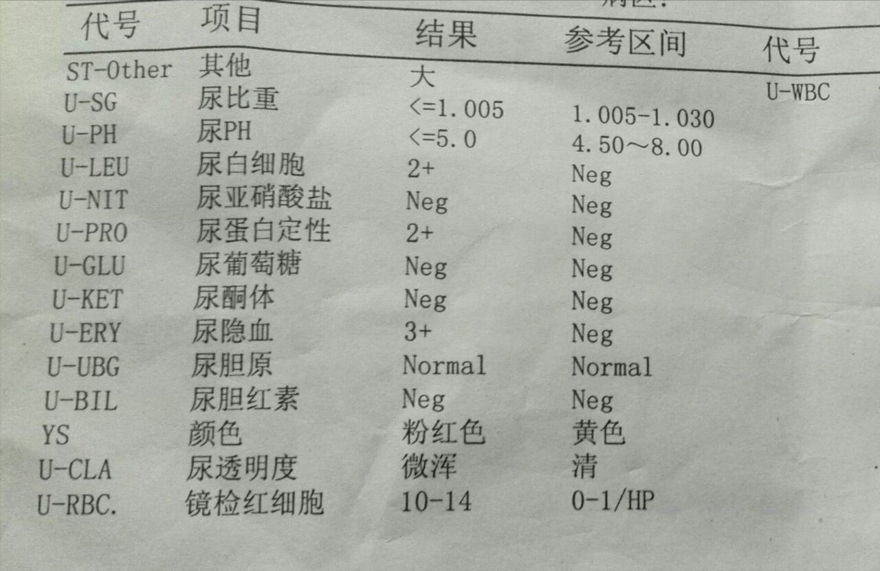 尿比重正常值图片