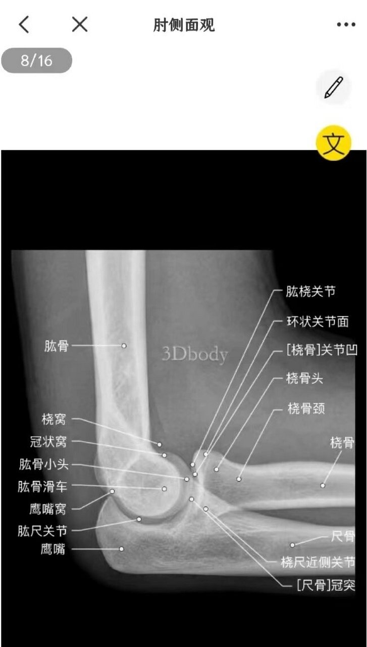 肘关节侧位解剖图图片