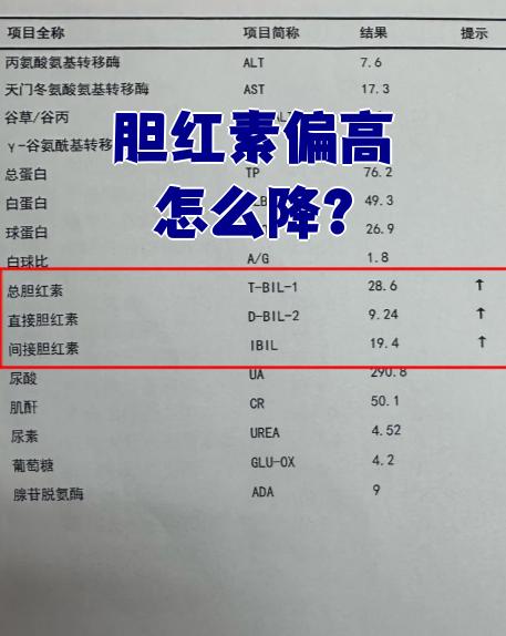 胆红素偏高要看具体原因,有些情况不用特别处理,有些则需要针对性