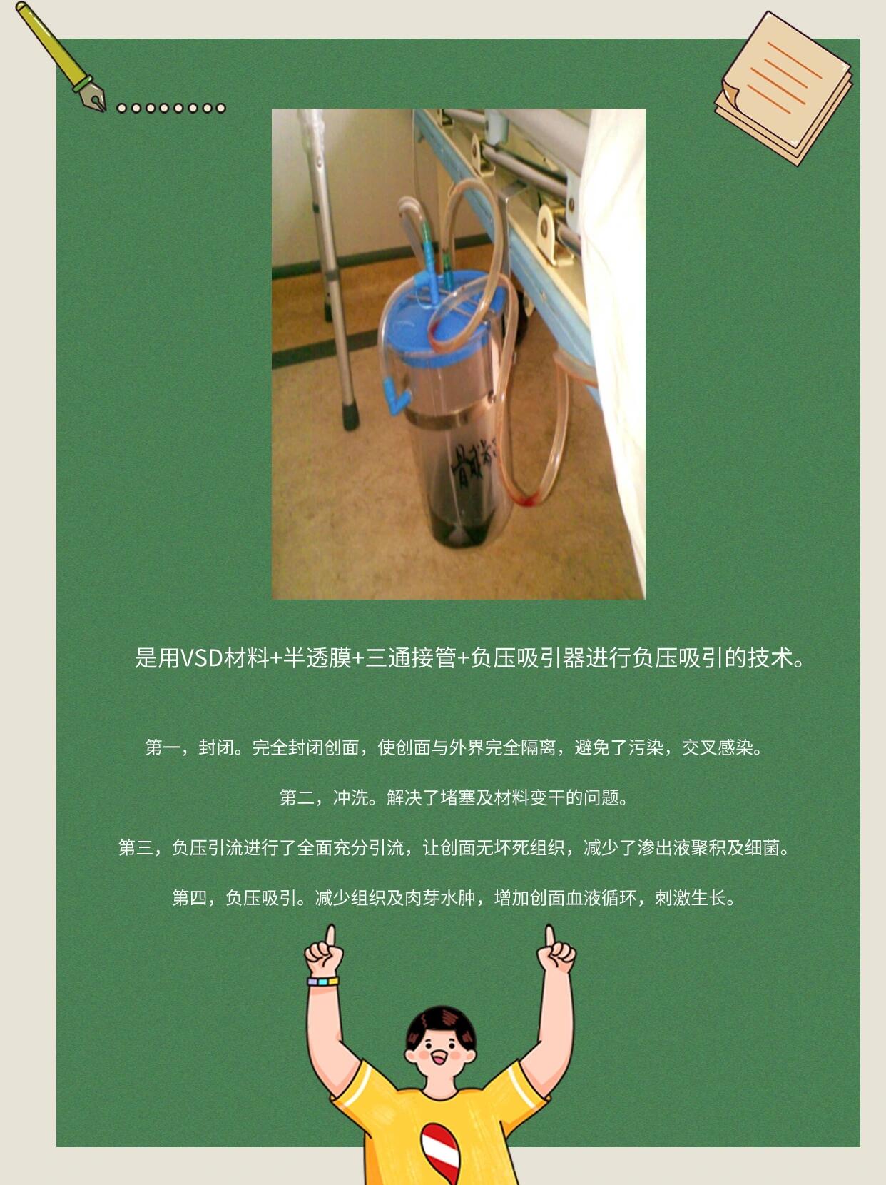 vsd负压封闭引流技术,指南 vsd负压引流技术是一种先进的伤口治疗技术
