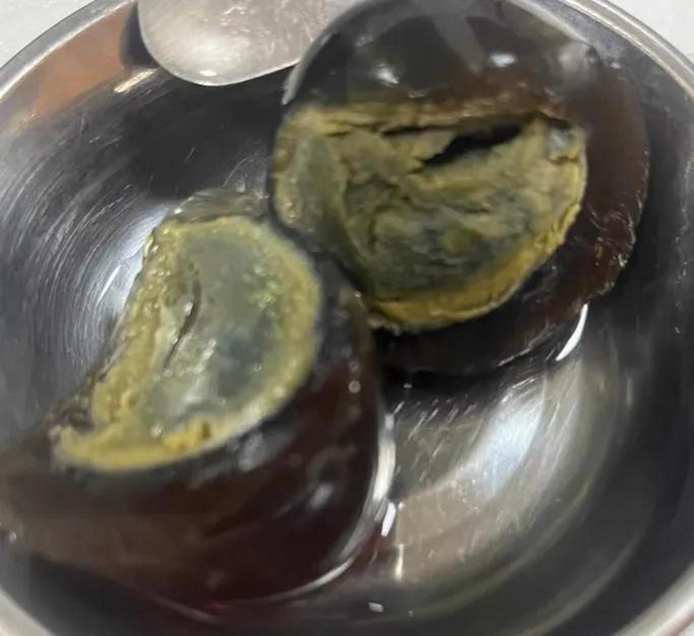 一颗皮蛋暗"爽"一天 图省时间,"吞"了颗皮蛋,嘴里一下午都在疼不知道