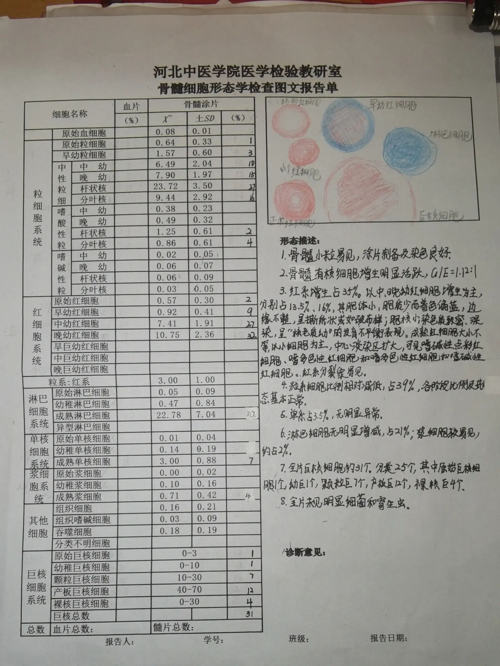 严重贫血化验单图片图片