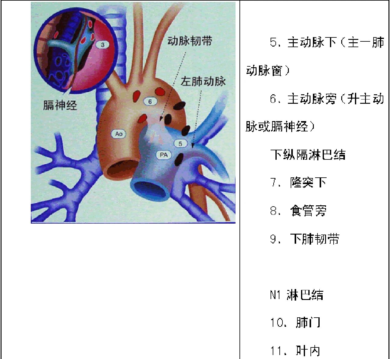 肺癌淋巴结分组 n1:同侧支气管周围淋巴结转移,或同侧肺门淋巴结转移