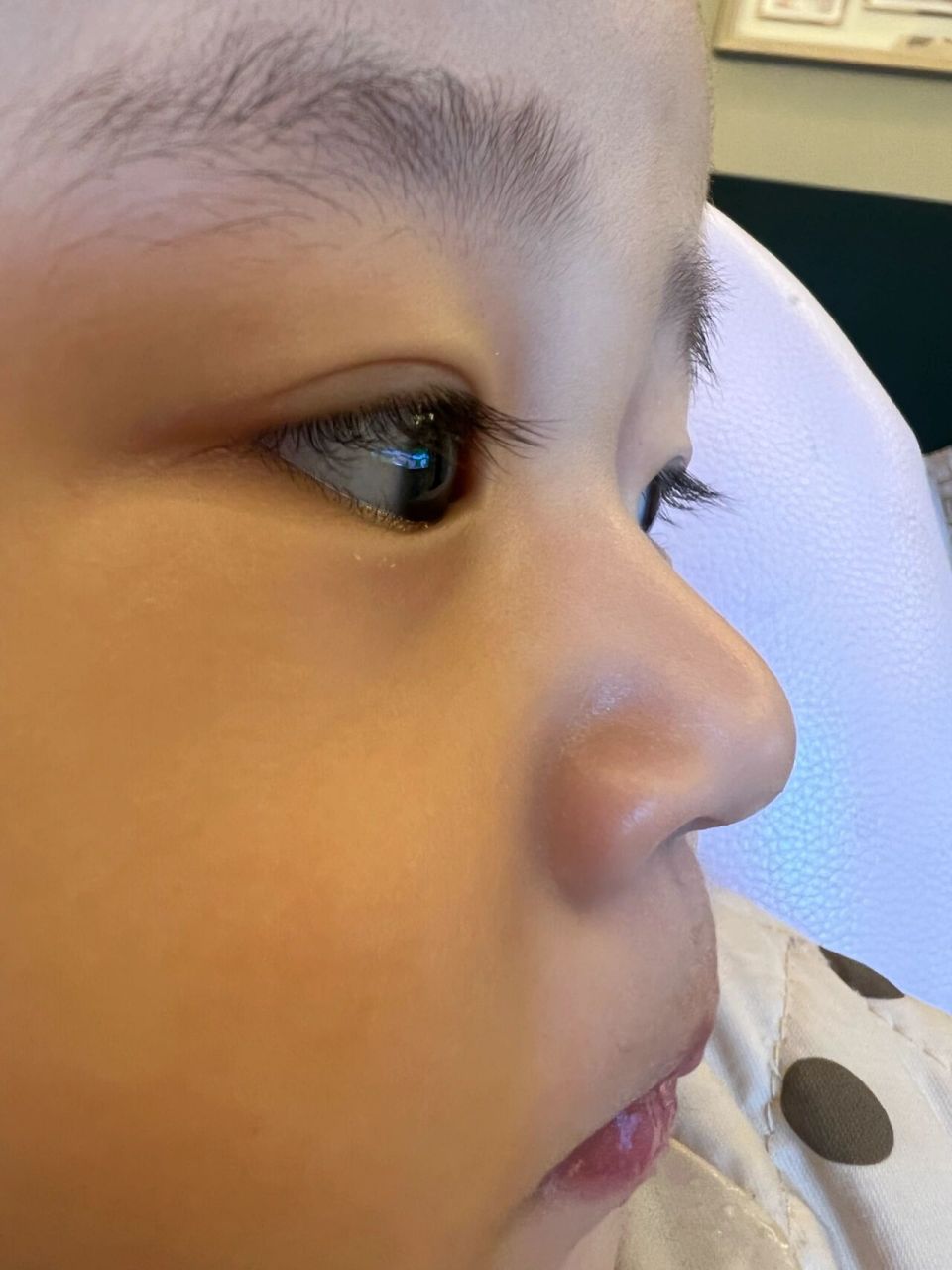 四维时被这个大鼻子吓坏了(四维图已上) 四维图里鼻子真的好大,生下来