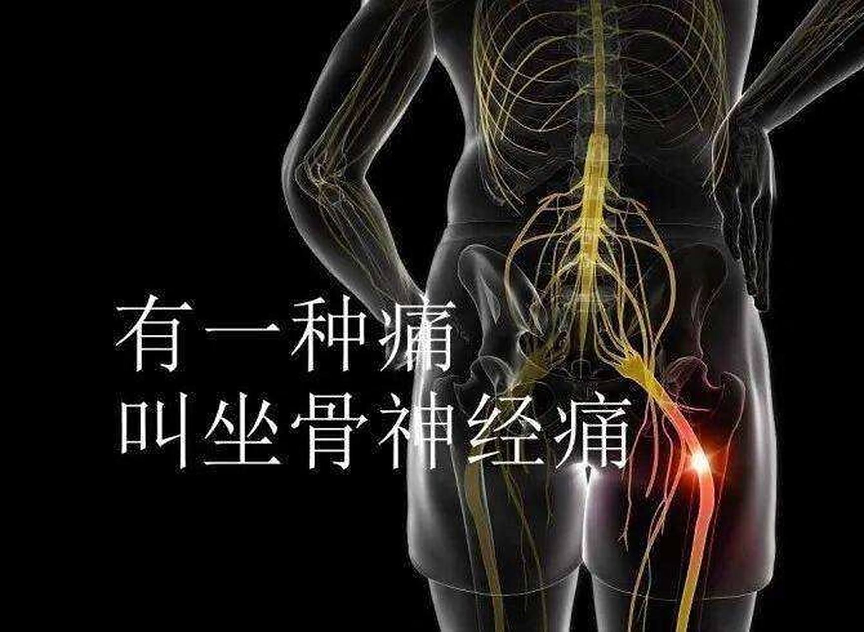 孕期坐骨神经痛 从怀孕就开始痛,如图的这个位置,我是左边96,到25周