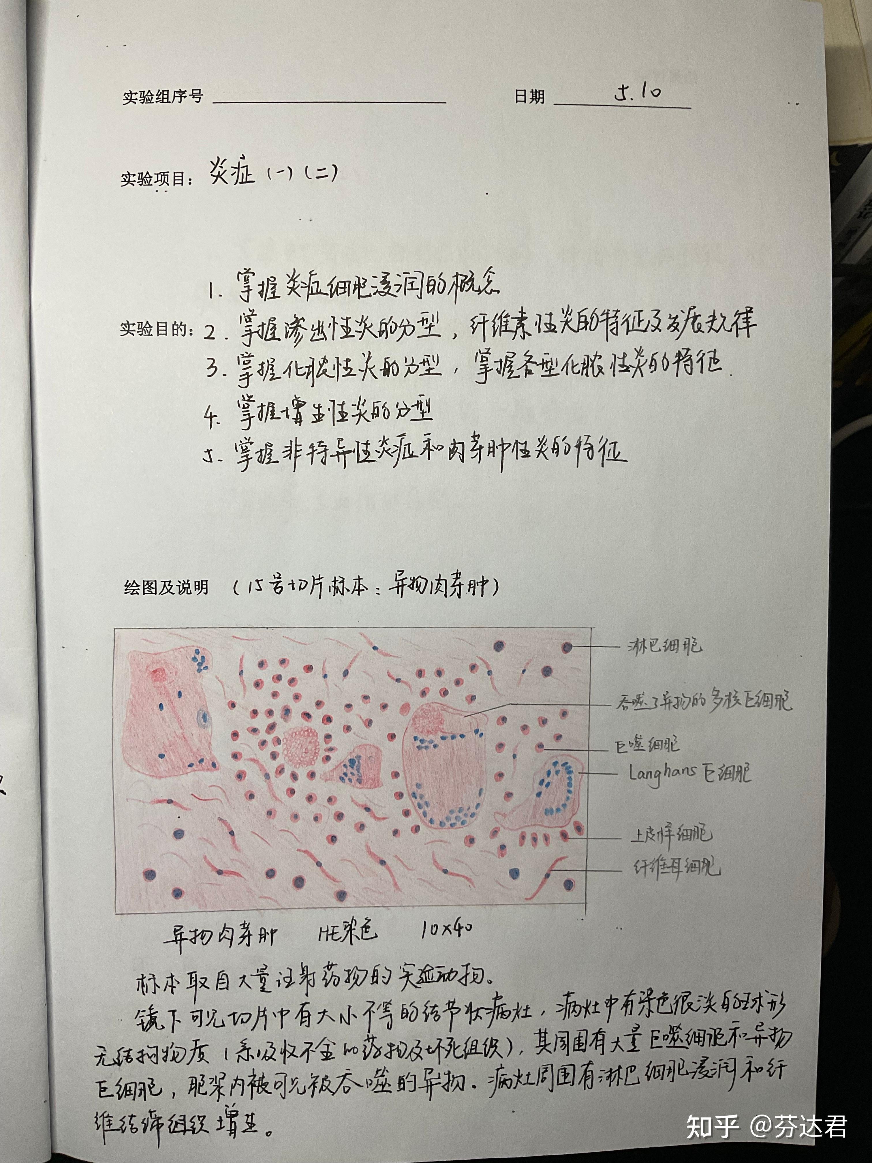 肠上皮化生红蓝铅笔图片