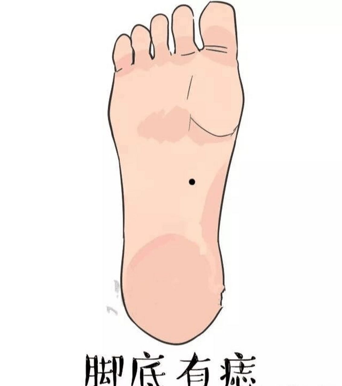 脚底有痣代表什麽 脚底有痣,多为善痣,长在不同位置,代表含义不同.
