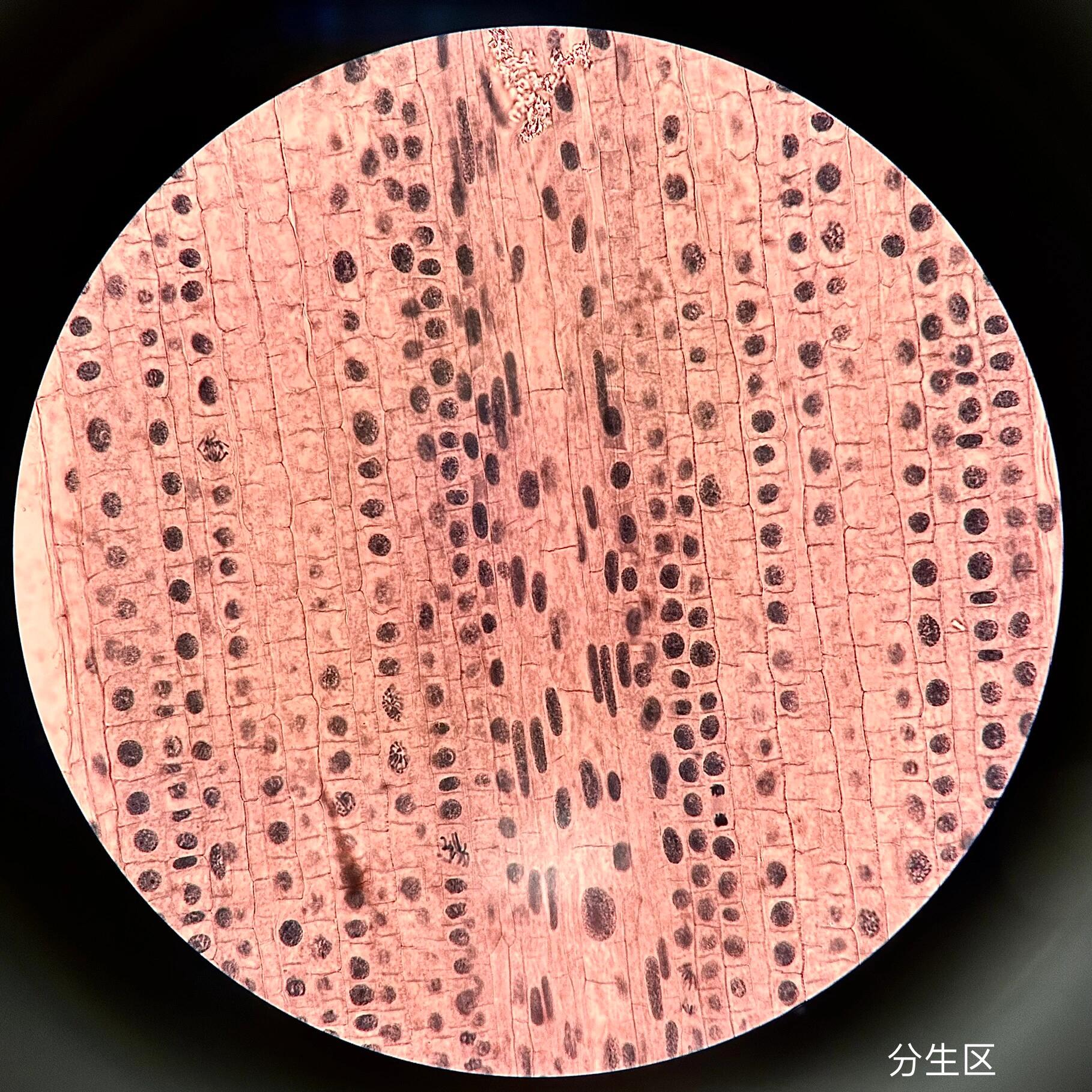 洋葱根尖间期图图片