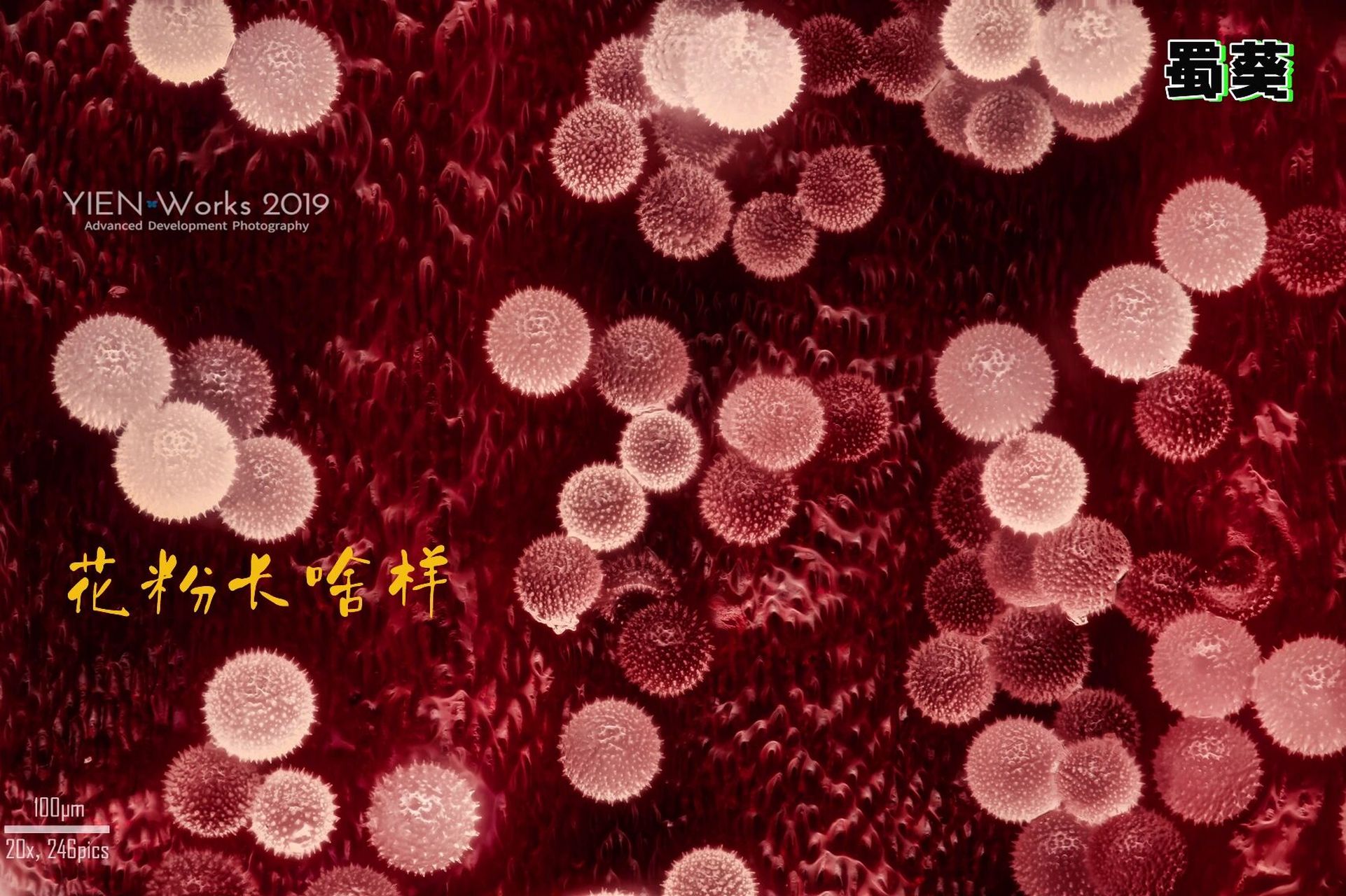 花粉长啥样     花粉粒 : 花粉粒(pollen grain ) 在雄蕊花药的花粉囊