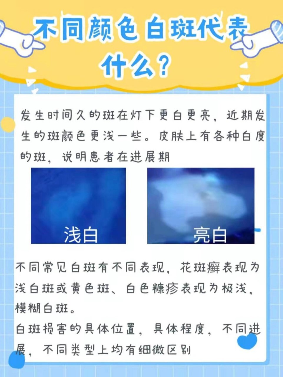 伍德灯检查