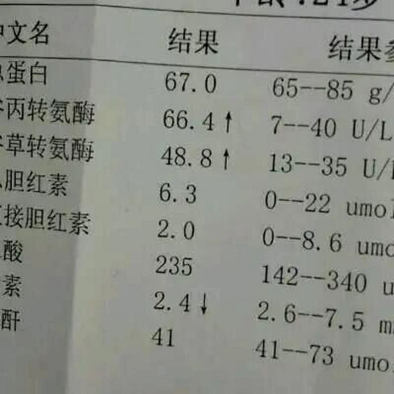 转氨酶 体检表图片