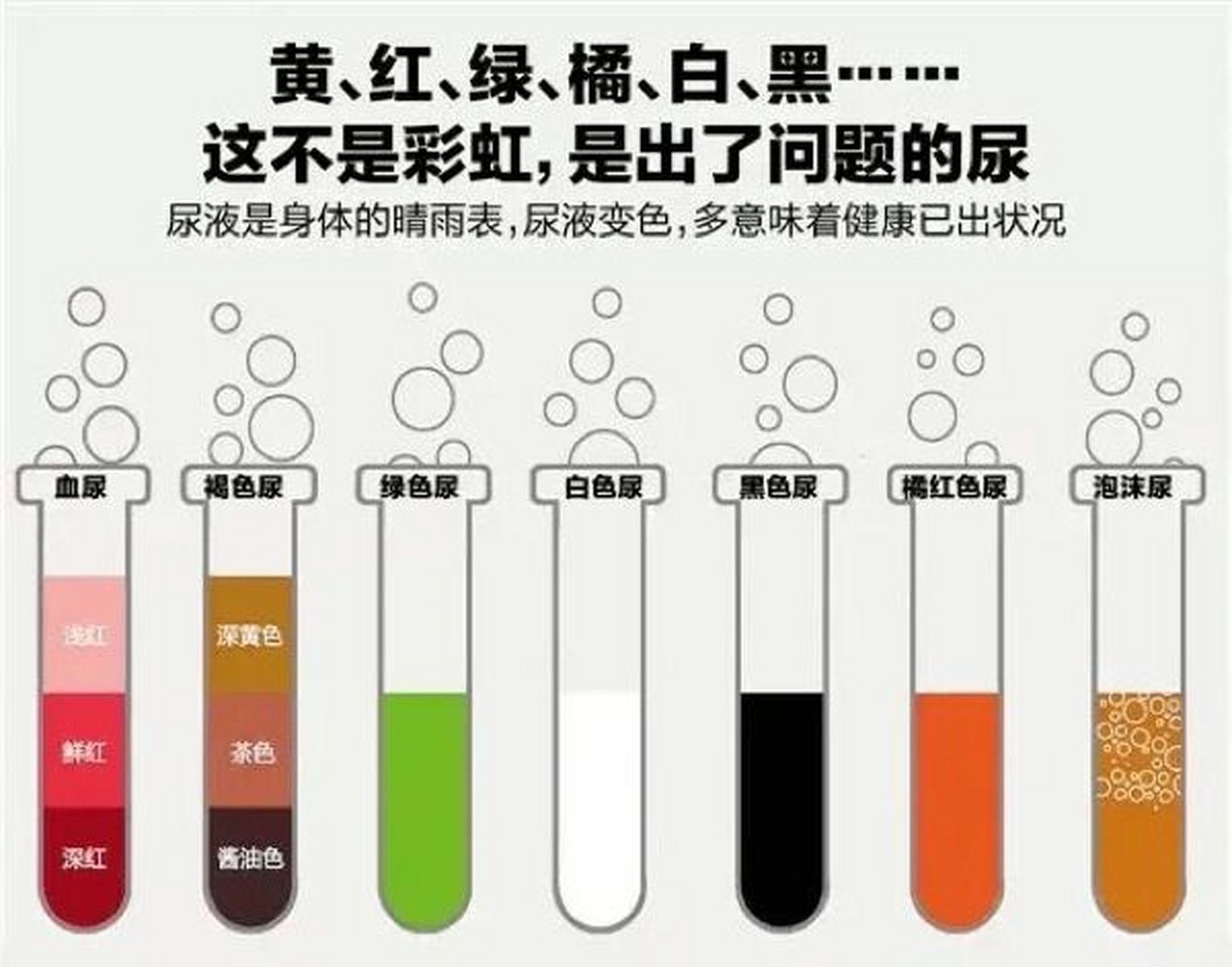 尿完别冲 从尿液颜色观察你的健康状况 尿尿是我们机体清理代谢物的