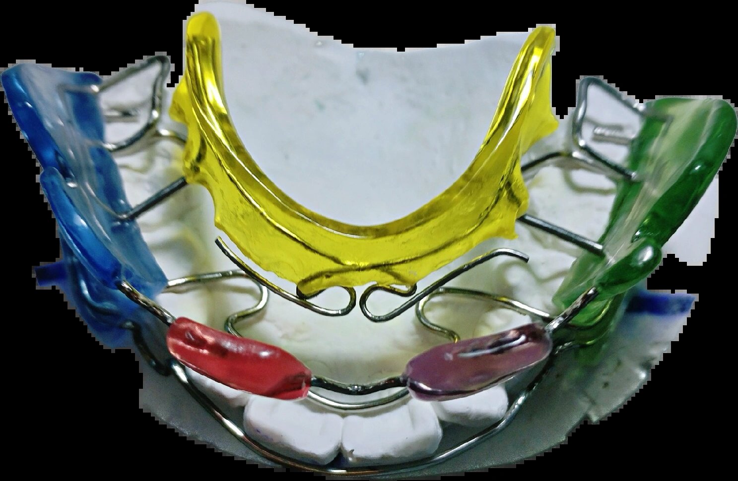 fr法兰克2功能型矫治器(frankell) fr功能调节器(frankel) 作用原理