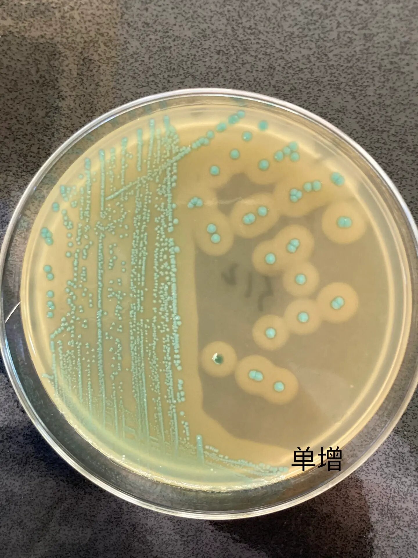 大肠埃希菌血平板图片