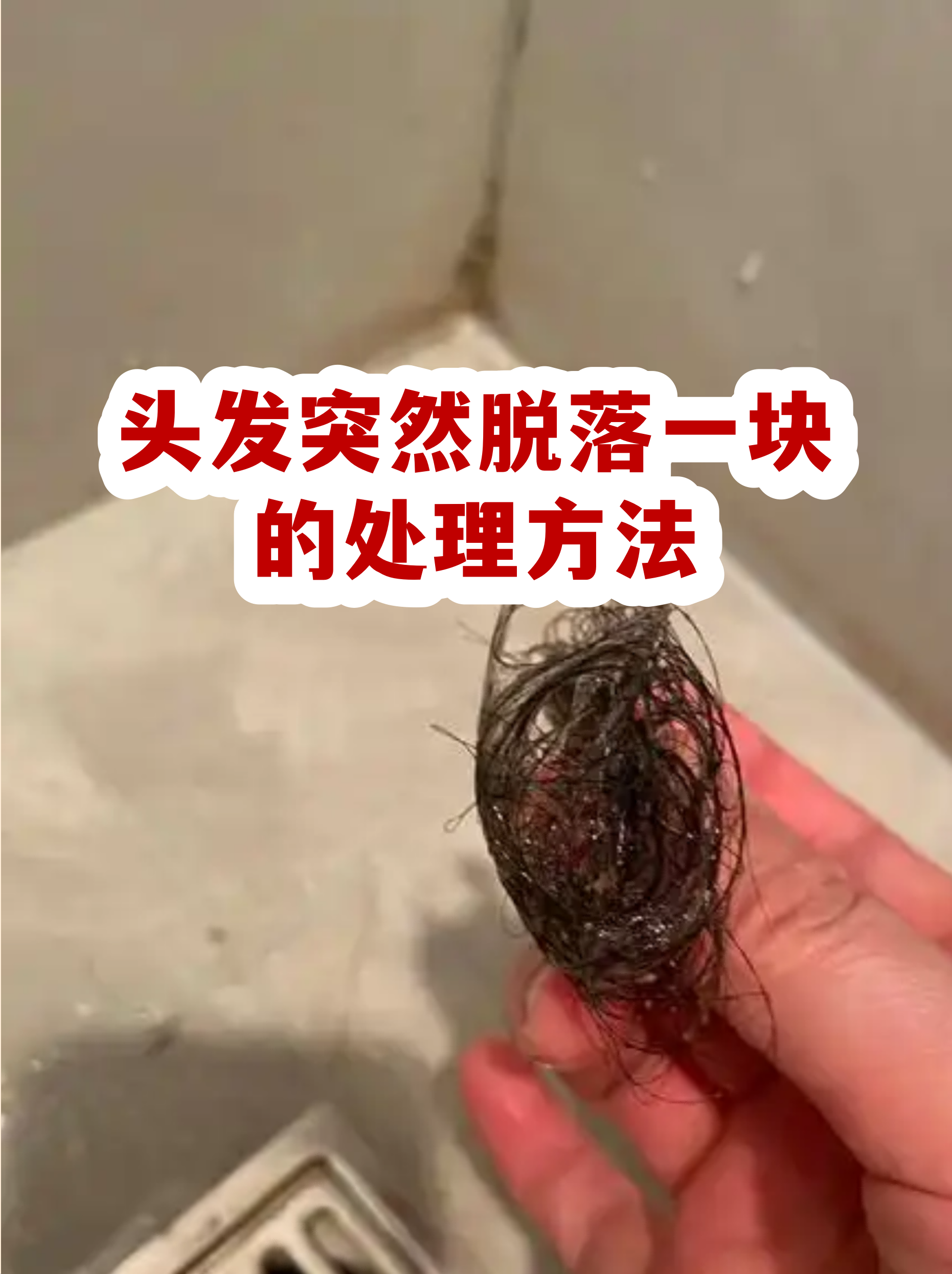  最近掉发严重有什么方法解决(最近掉发特别严重怎么办)