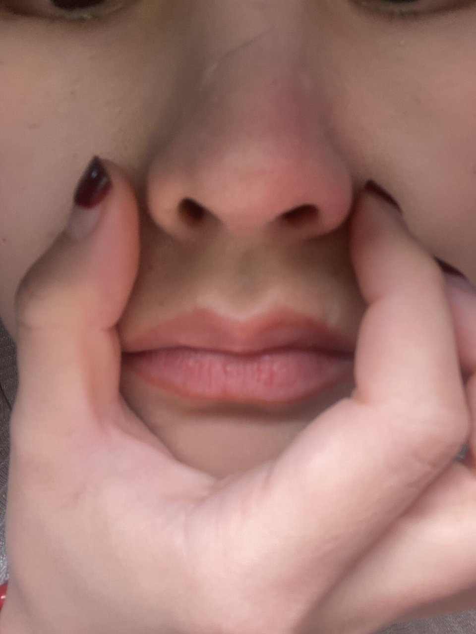 我隔一阵就会某一侧鼻翼红肿 还很痒! 变的硬硬的! 还会跳动!