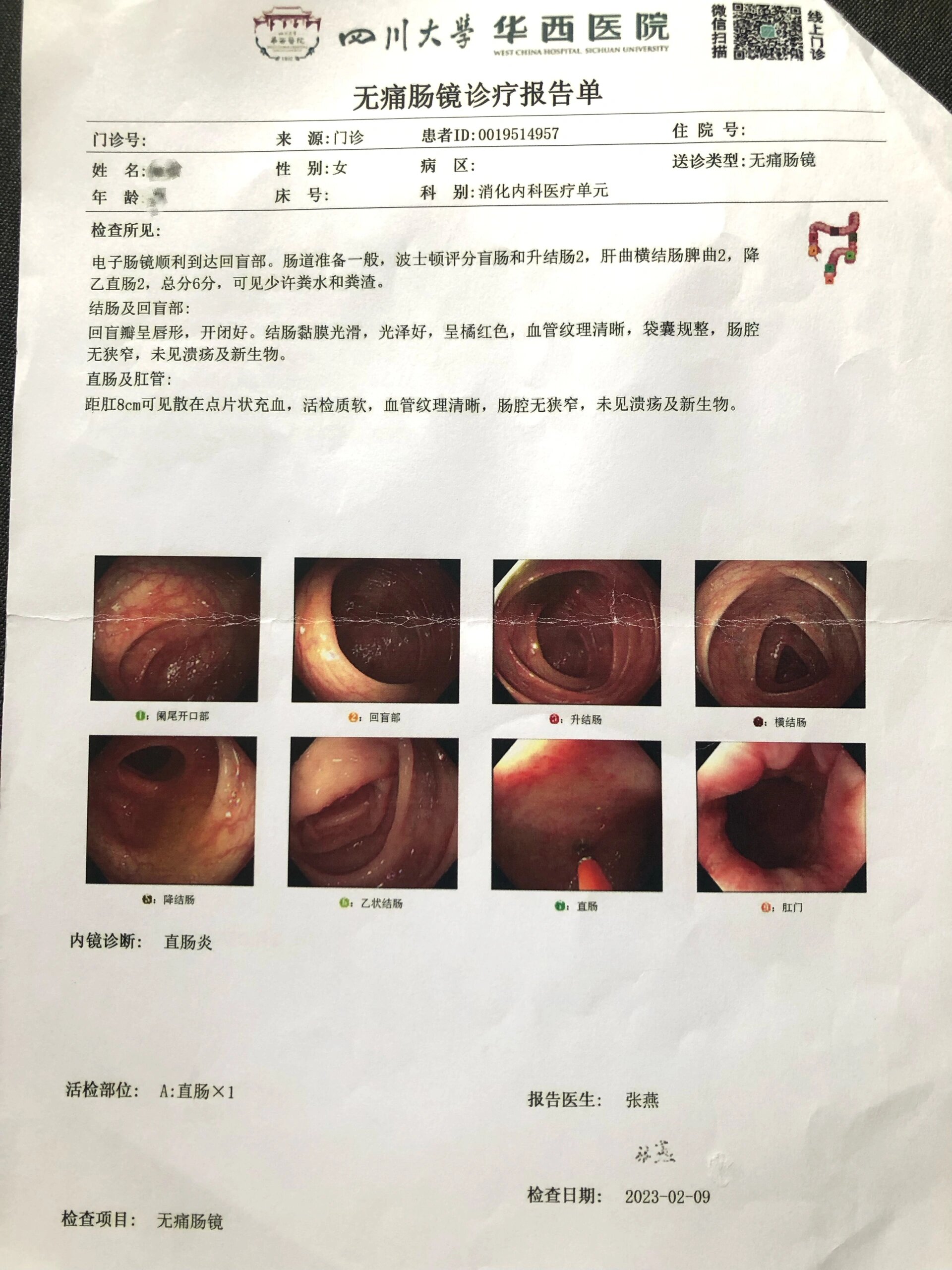 直肠炎怎么治疗?