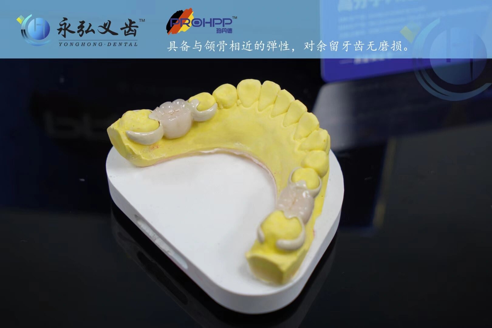 全瓷粘结桥图片