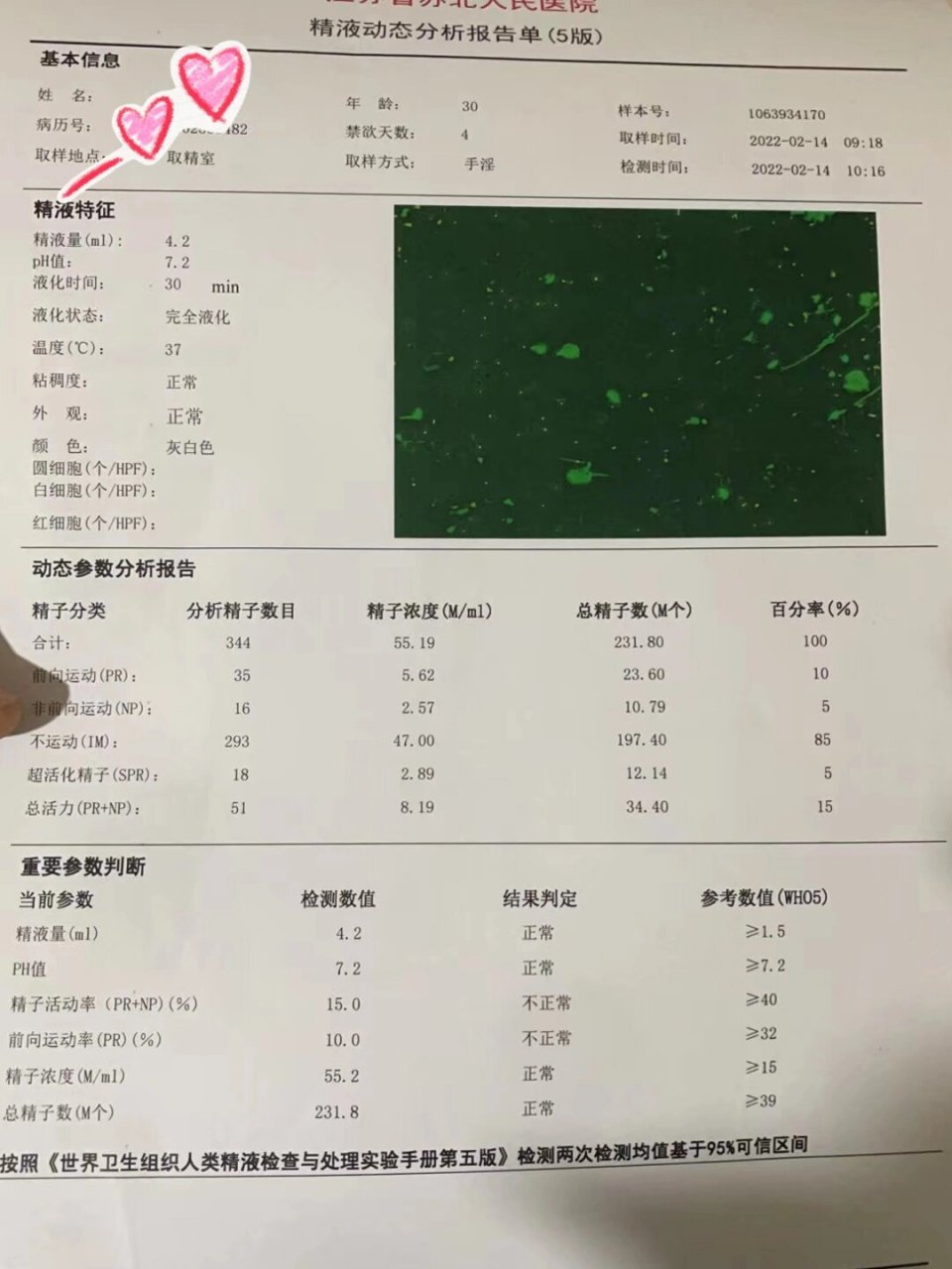 吃了一个月药,精子顶体酶居然正常了 结婚4年了一直没怀上,老公精子