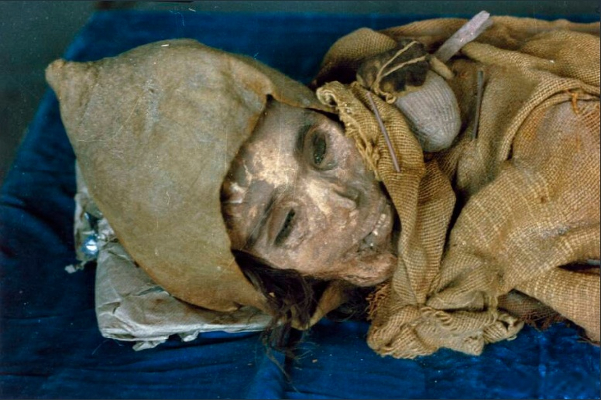 新疆出土的干尸,1981年