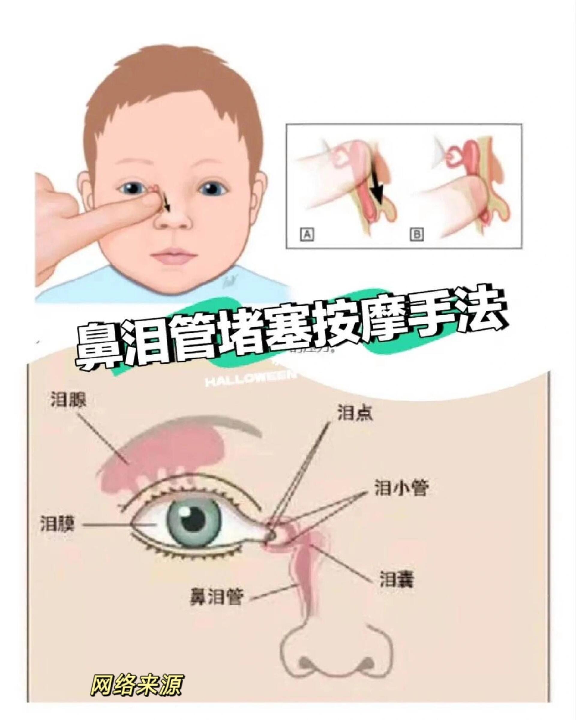 宝宝鼻泪管堵塞不要慌,正确清洁十按摩❗❗