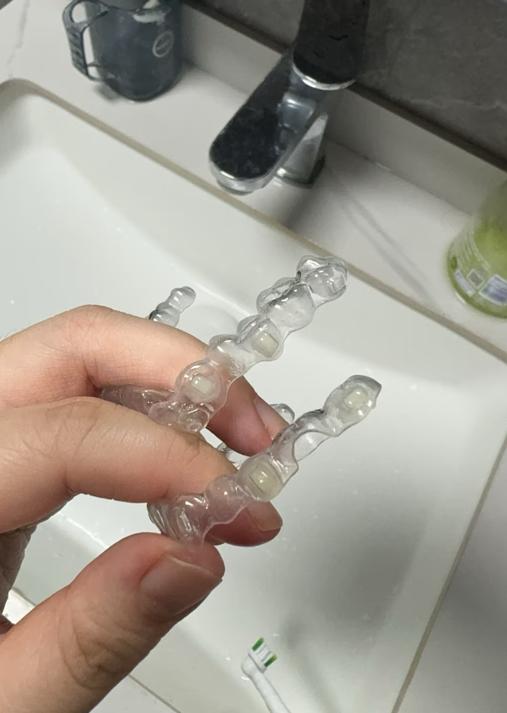 这种牙套是用3d技术专门为你定做的,由一系列透明牙托组成