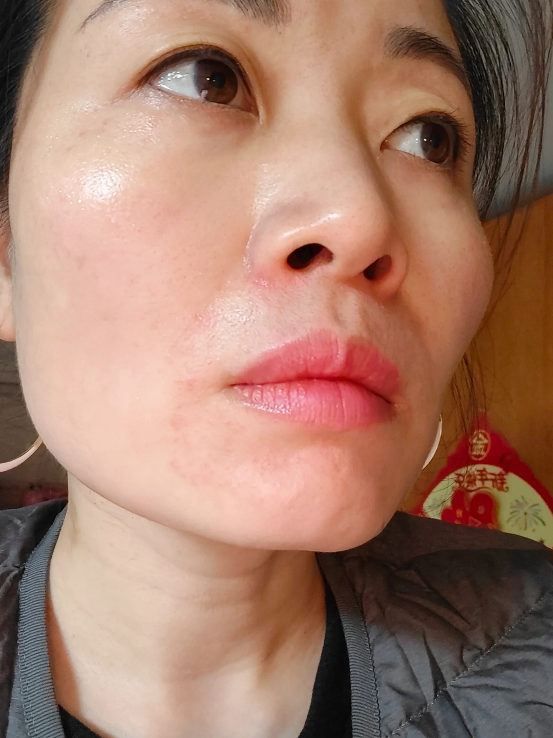 嘴角周围起红疹,反反复复不好