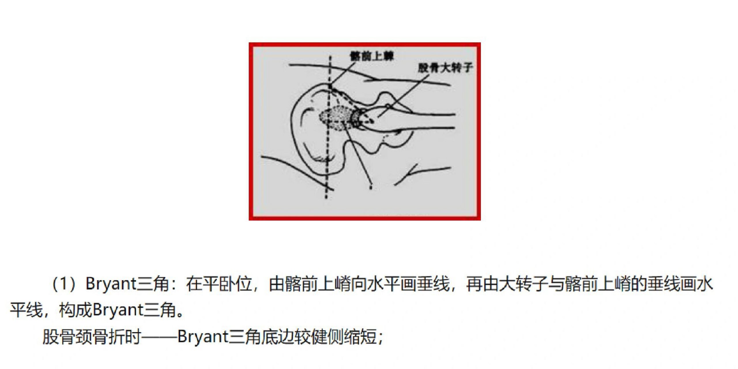 bryant三角底边缩短图片