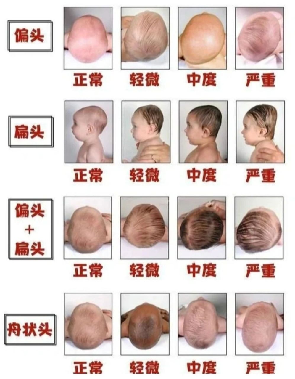 宝宝头型长大会变好变圆嘛?