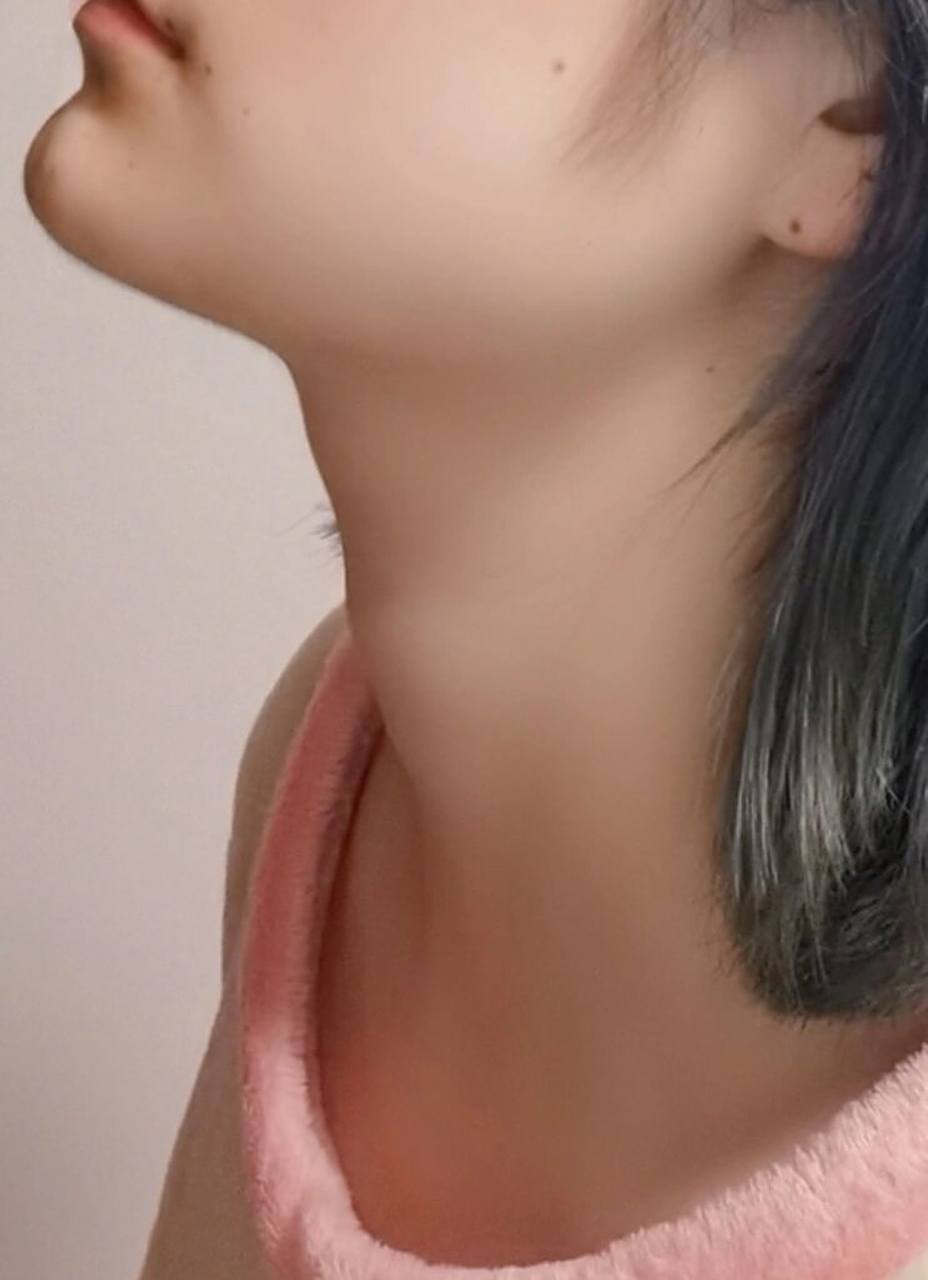 会这么突出九敏98我怀疑自己不是个女的无意间翻照片发现自己有喉结