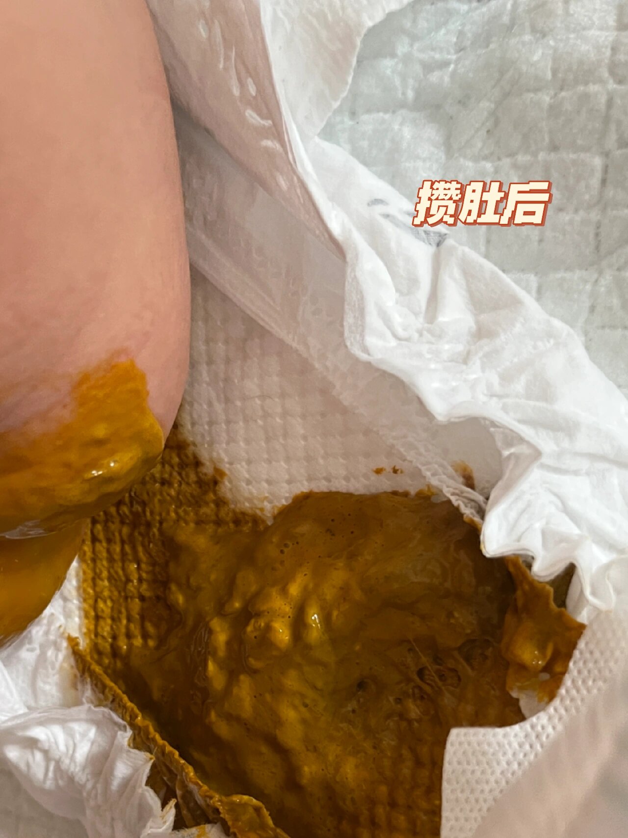 小月龄宝宝攒肚子 峻在3月龄,4月龄期间经历了最长