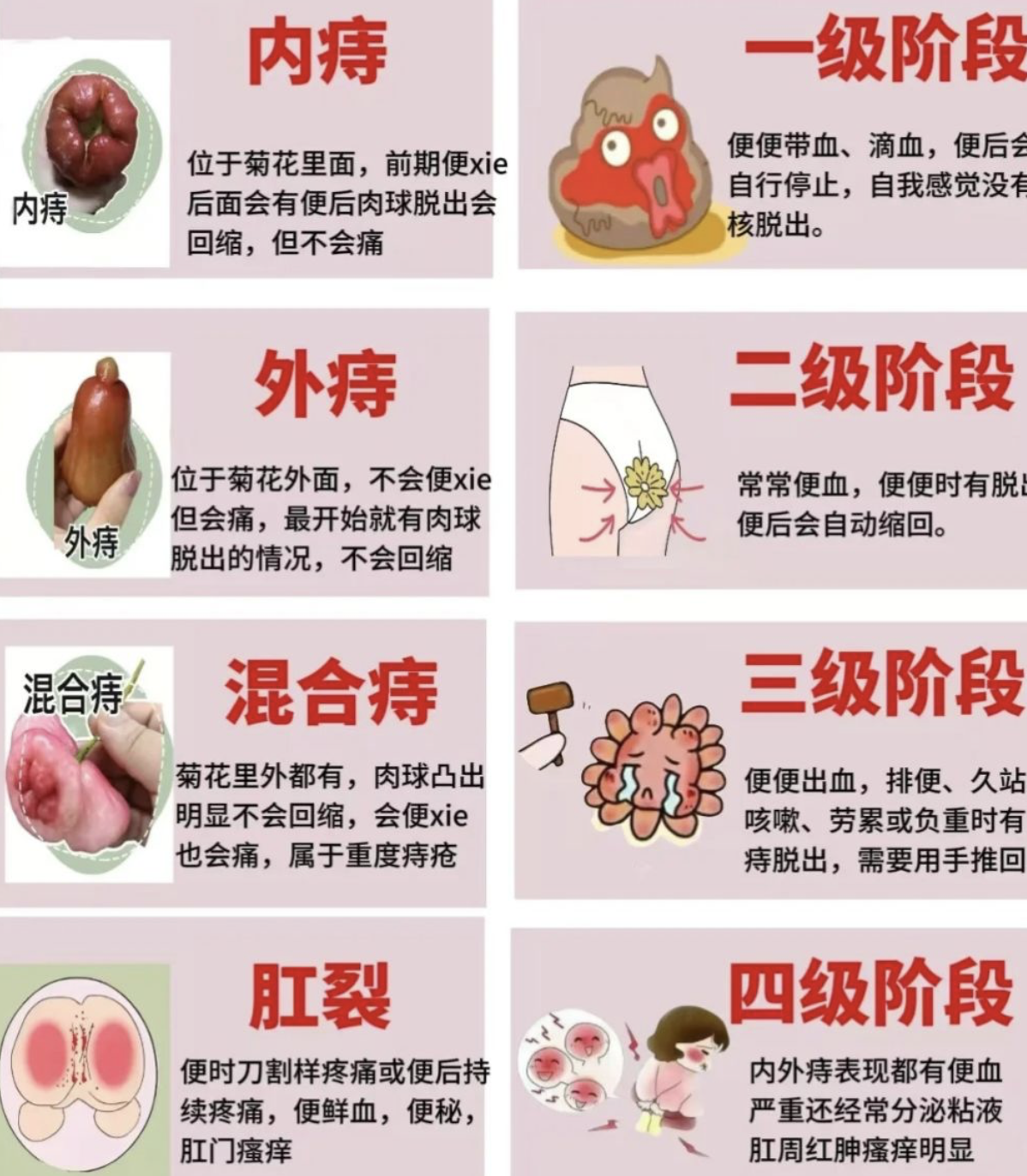 最常见的原因是痔疮,息肉或黏膜脱垂