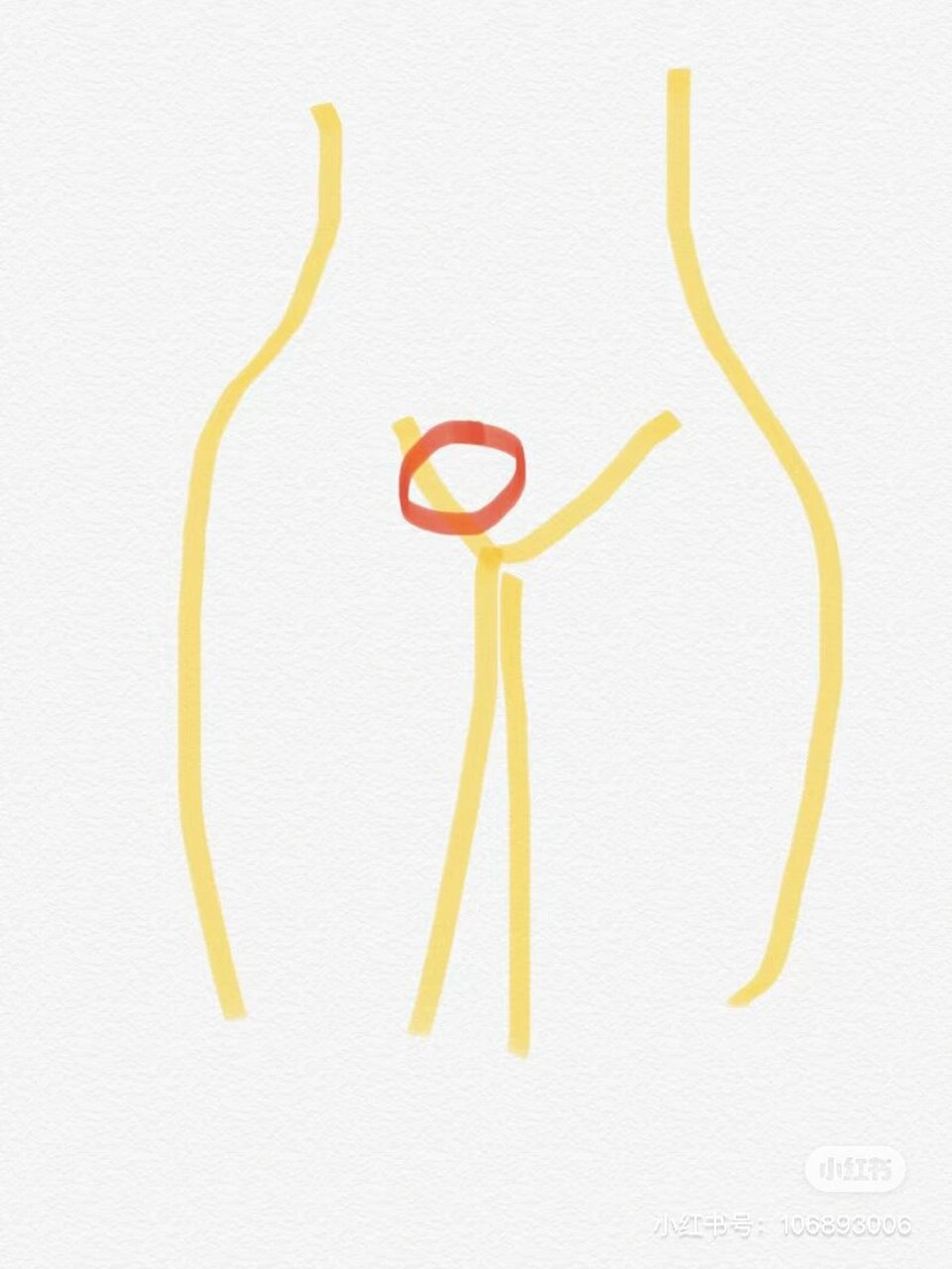 三角区右下腹疼 如图这个位置疼   ,靠近腹股沟处,手能摸到小疙瘩 ,像