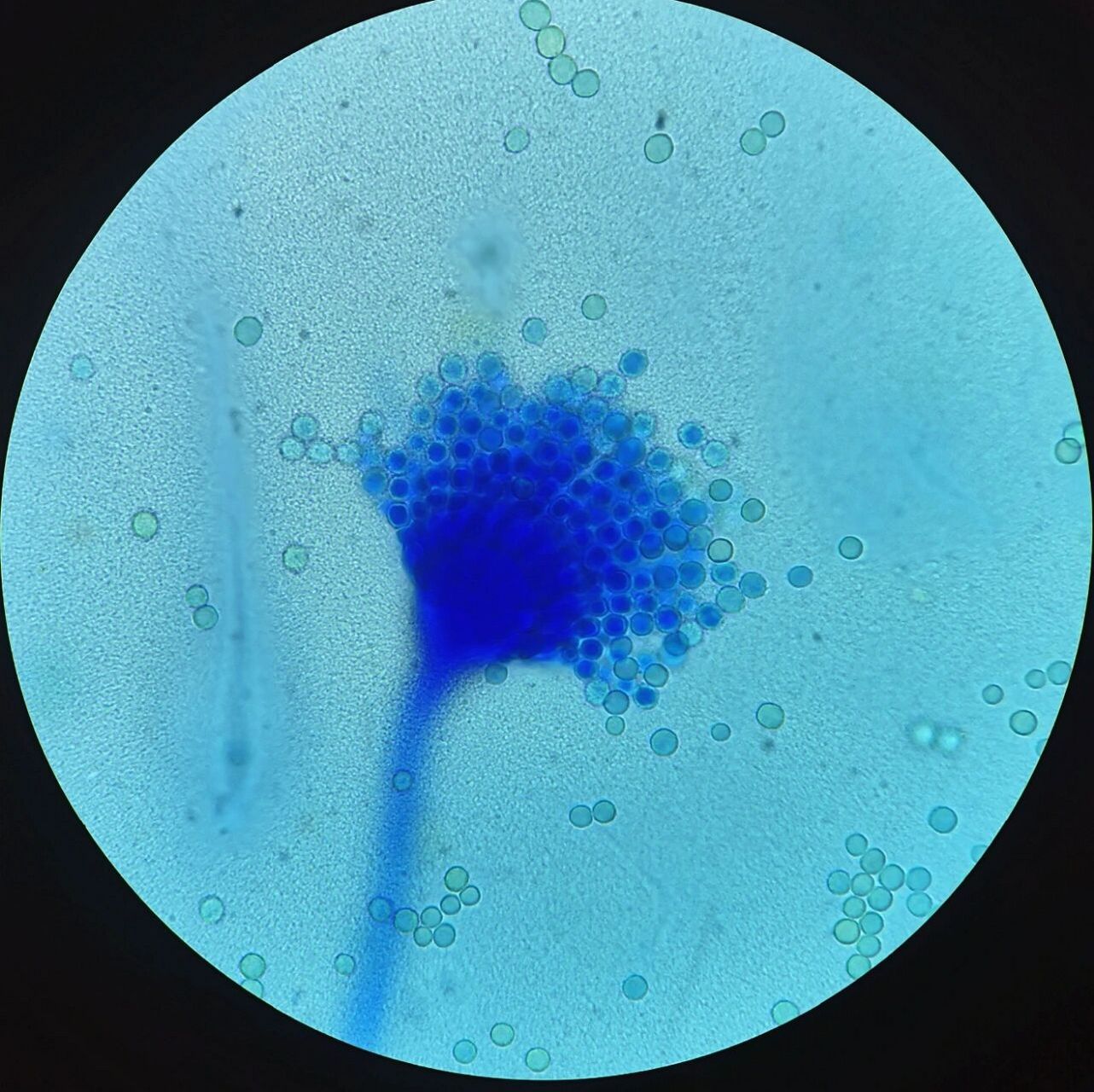 黄曲霉棉兰染色×1000 培养特征:黄曲霉菌在 sda 及 pda 培养基上25