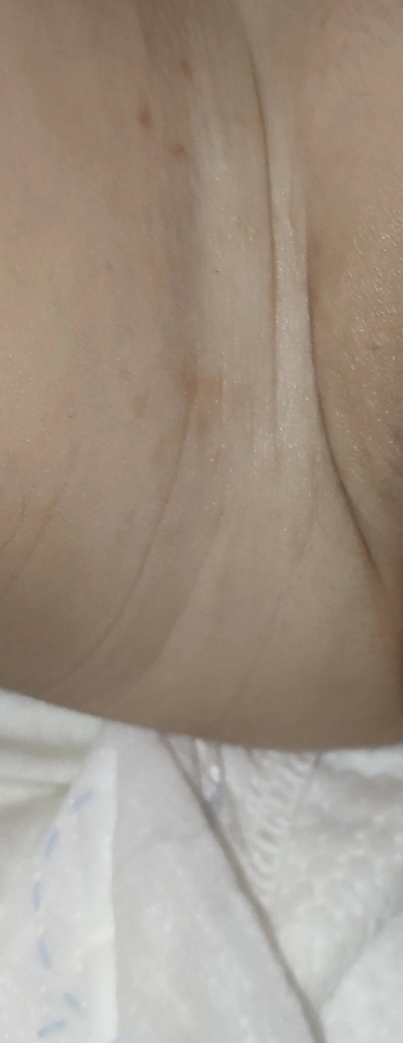 红屁屁/尿布疹 老母亲真的欣喜若狂,宝宝难受了一个月,我护理了一个月