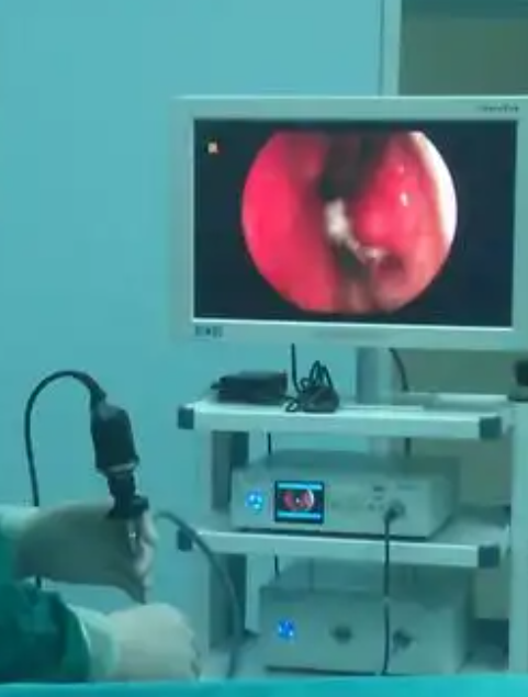 不管是鼻炎,鼻窦炎,鼻出血,还是鼻息肉,过敏性鼻炎,都可以去