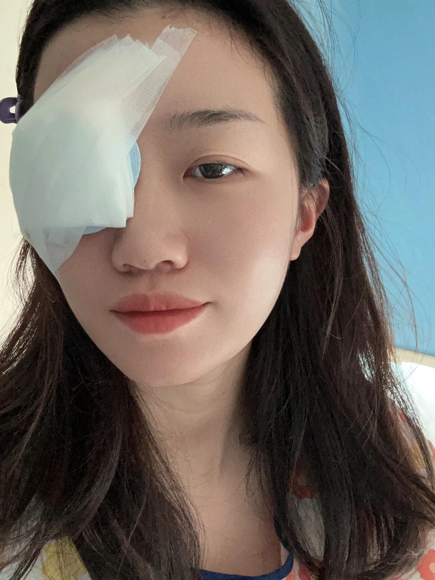 早上7:30护士小姐姐帮我清洗眼睛后盖上纱布 然后7:40到手术室,做好