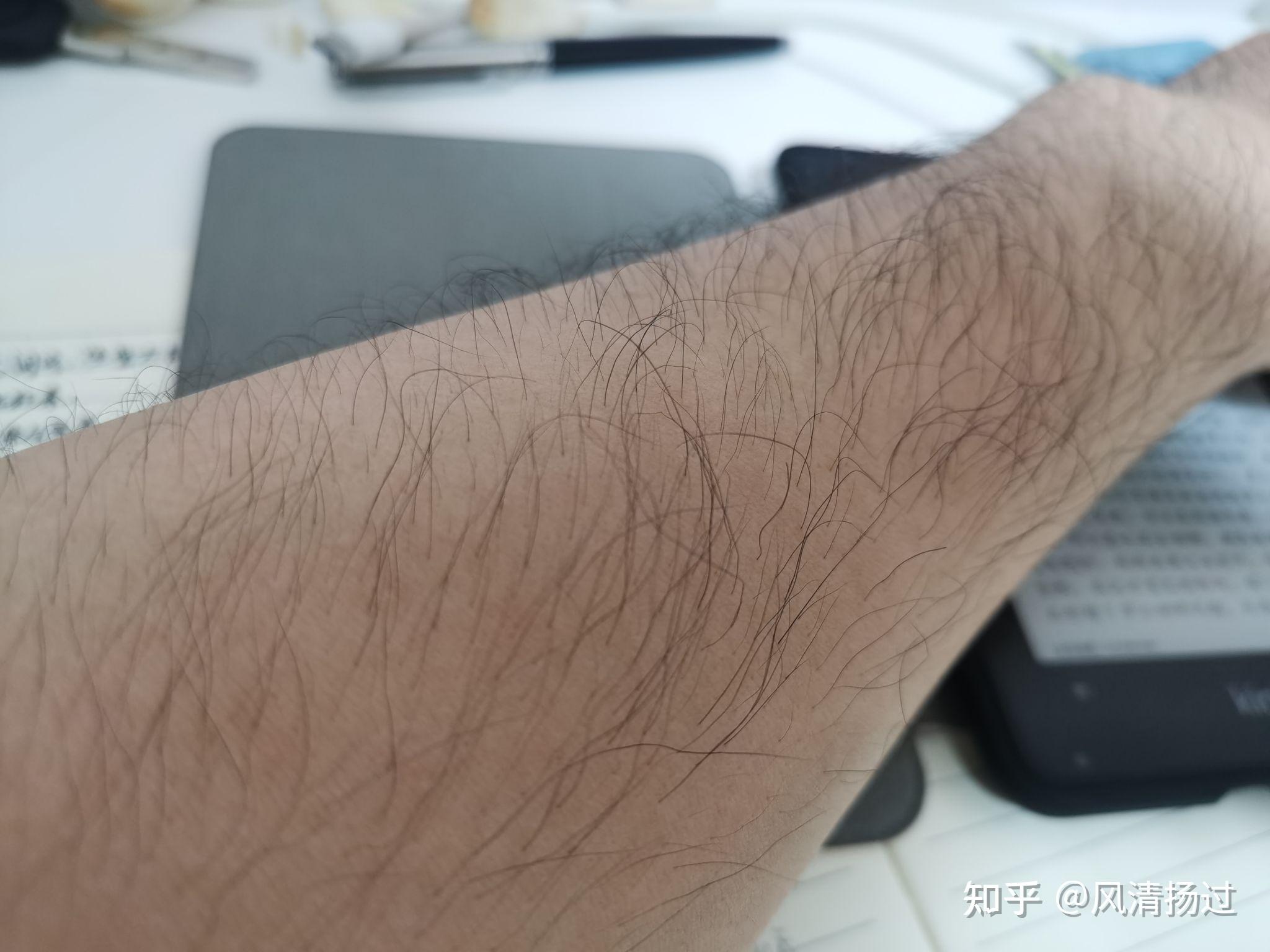 手臂汗毛多啊