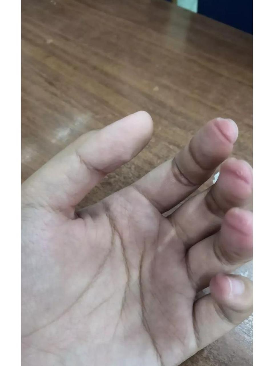 弹吉他手指不疼的正确练习方法,快收藏起来 初学弹吉他有2个拦路虎