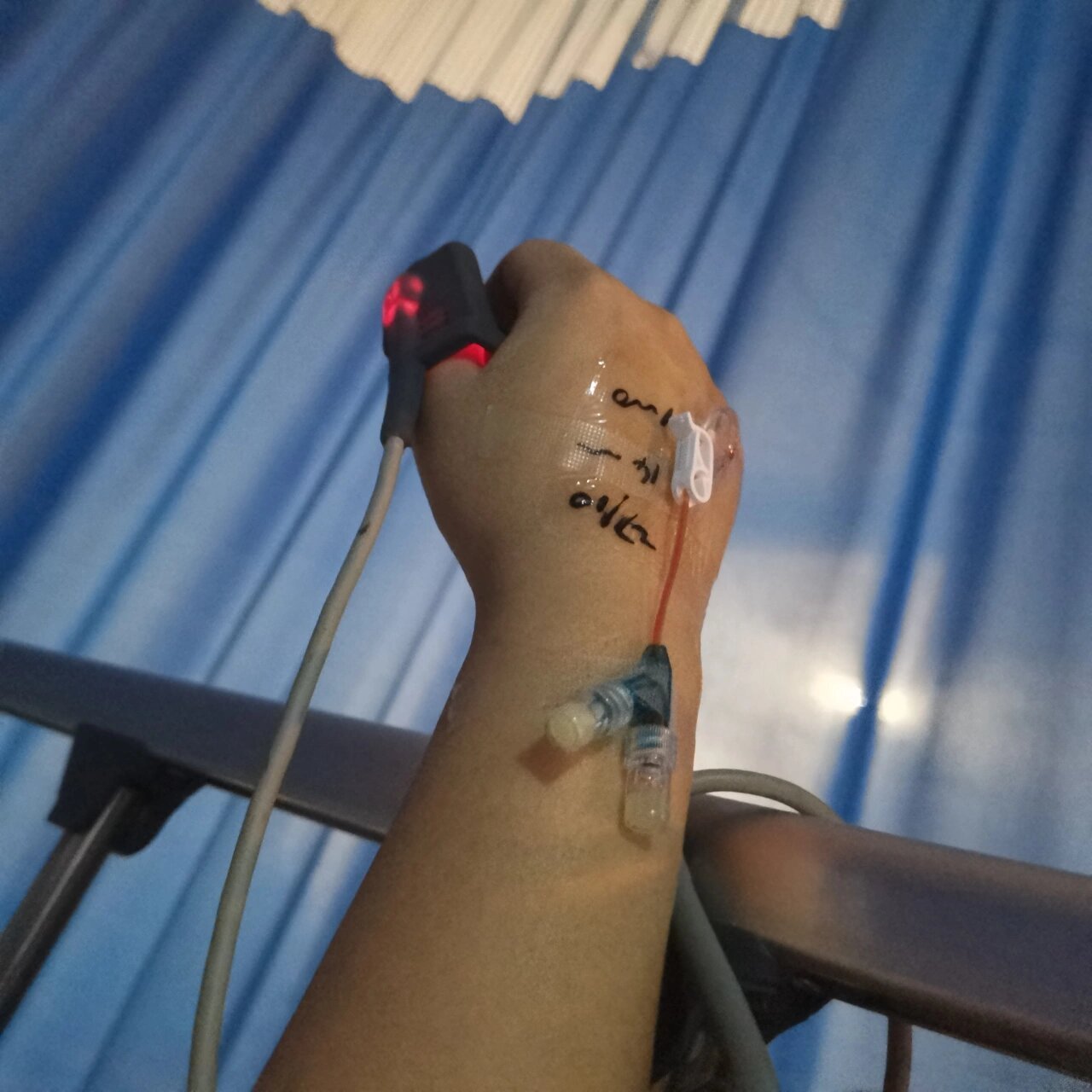 手术被加急安排在了今天下午,护士告诉我要插胃管!