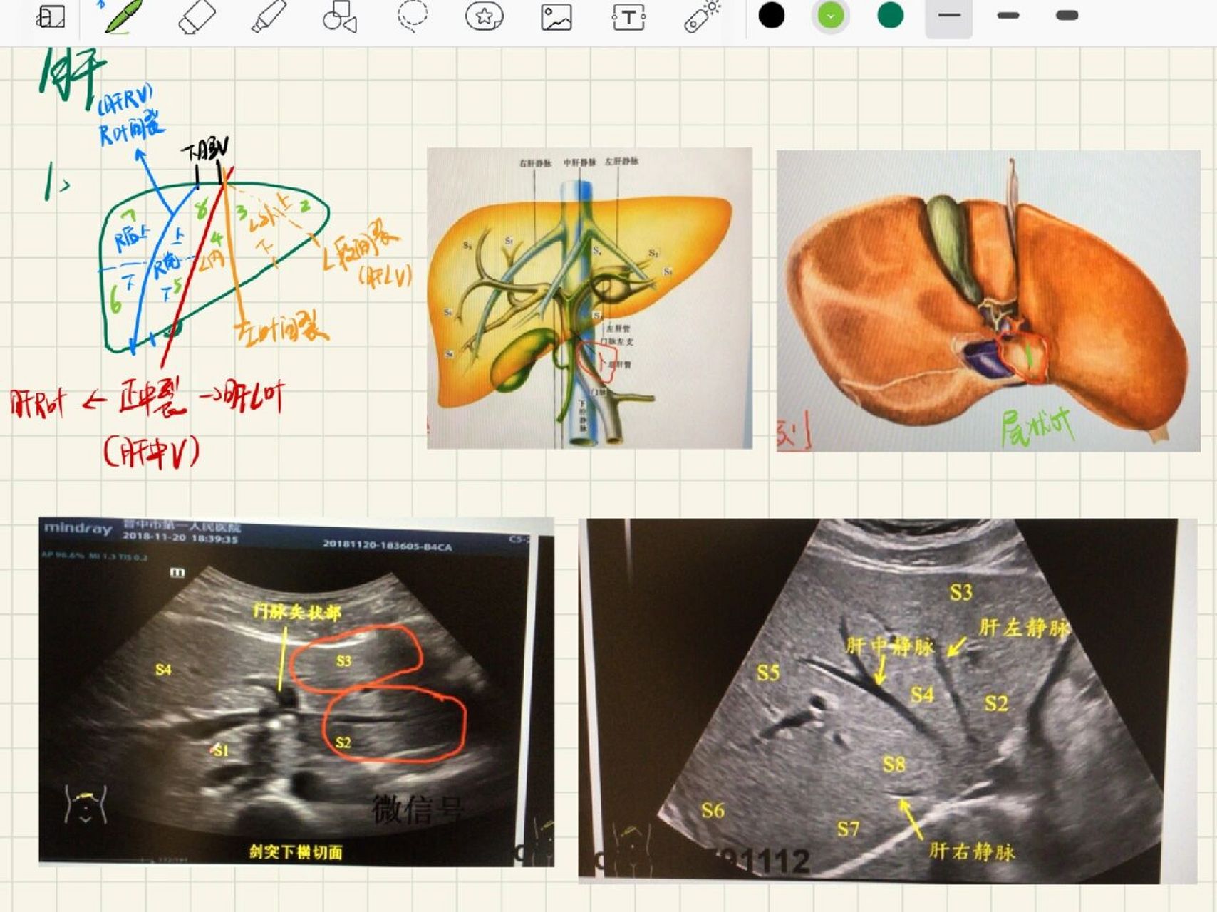 肝超声分段 难搞哦,每日一看,看完就忘,下次再看