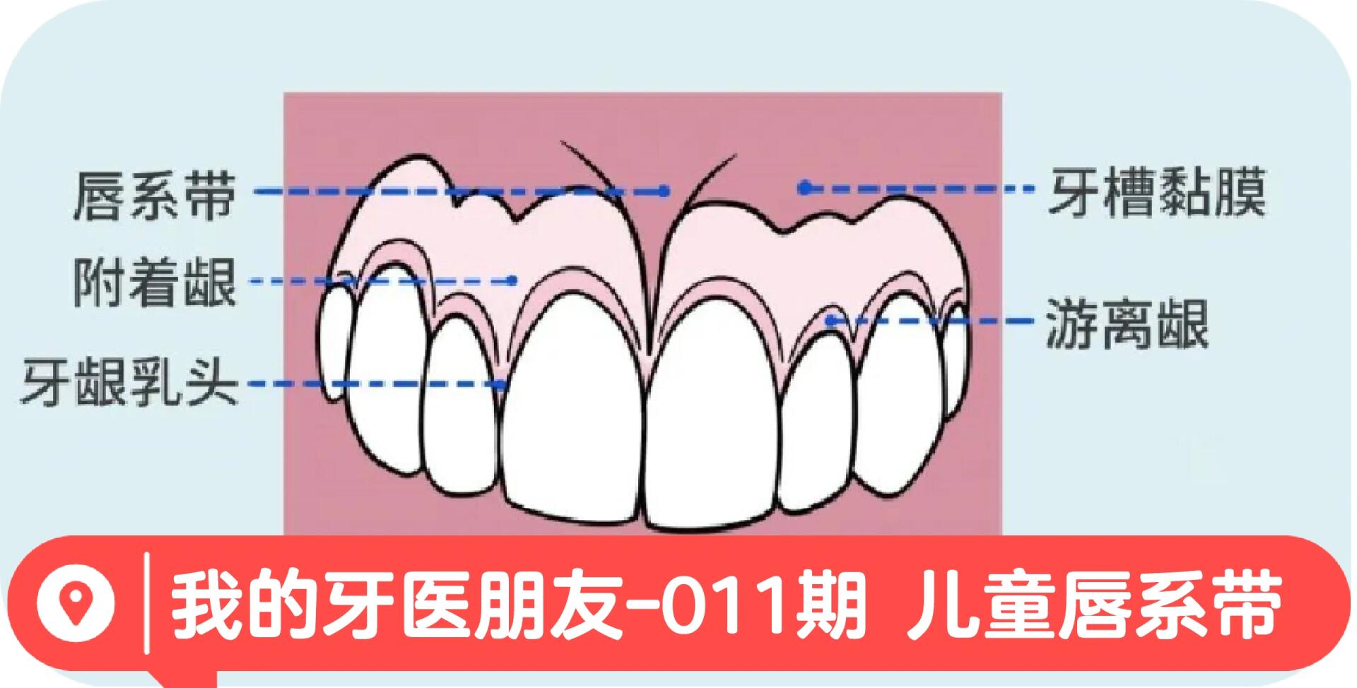 检查完后觉得孩子唇系带是有点过低,但是还不至于需要马上治疗,建议