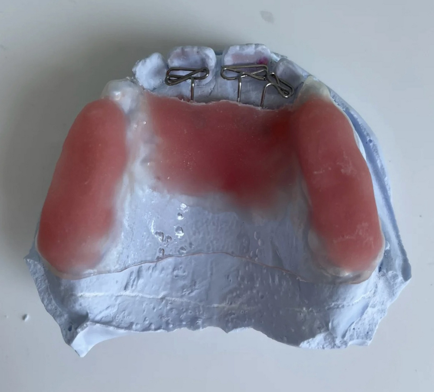 正畸必看之-双曲舌簧矫治器制作3 重新编辑,下载图片自动带logo