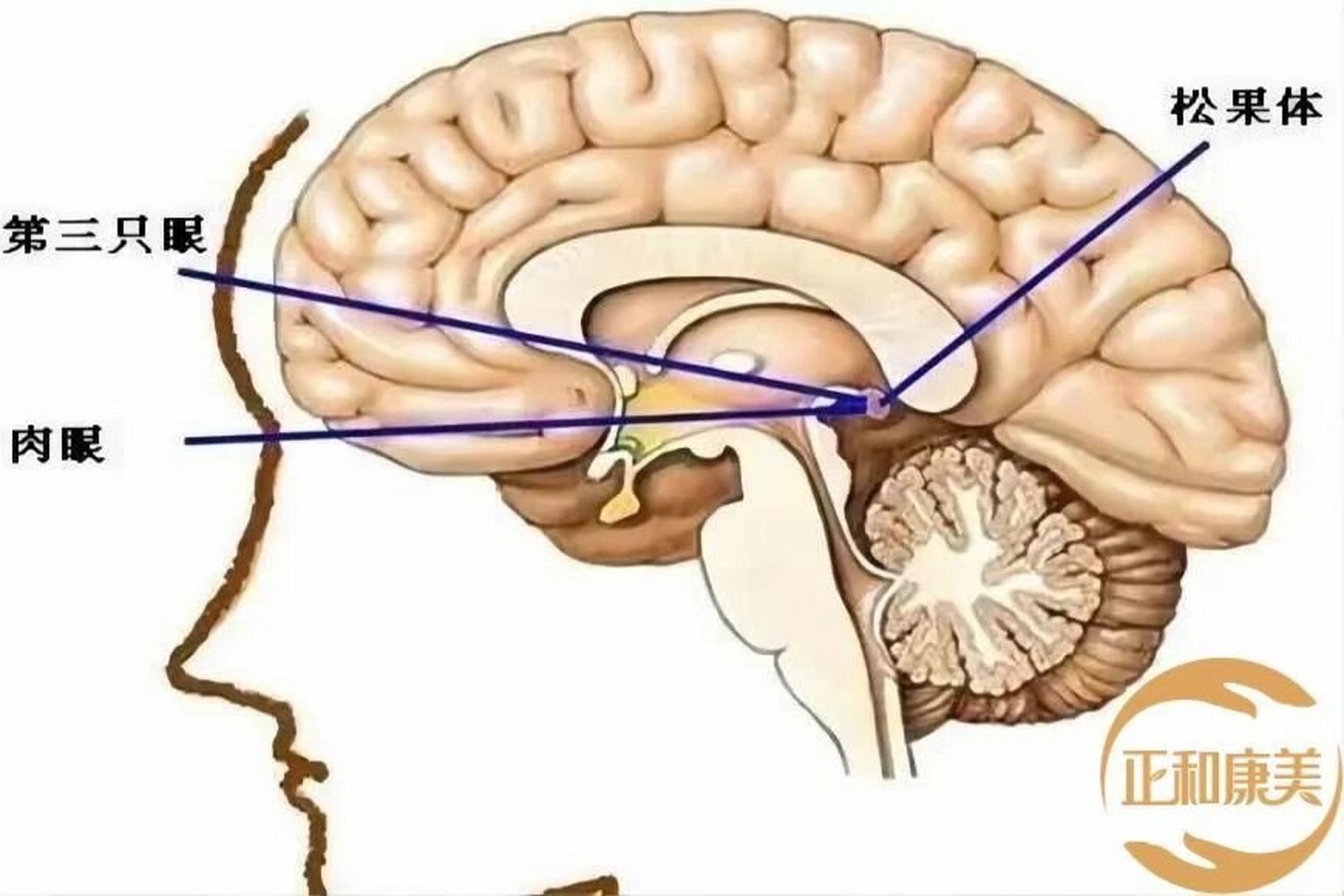 92颅骶早分享之松果体97 1,松果体呈扁圆锥形,形似松果,以柄附于