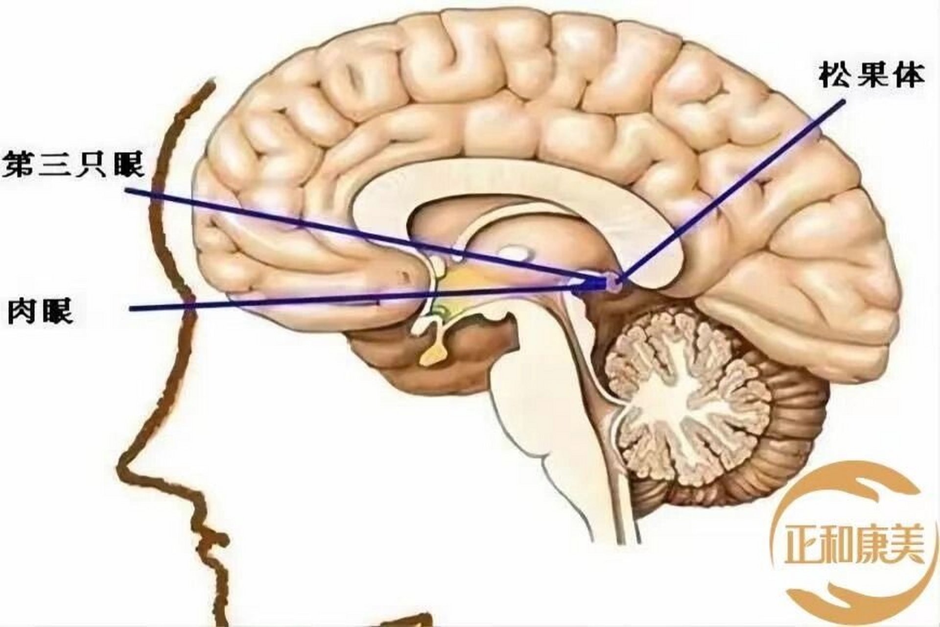 松果体连于图片