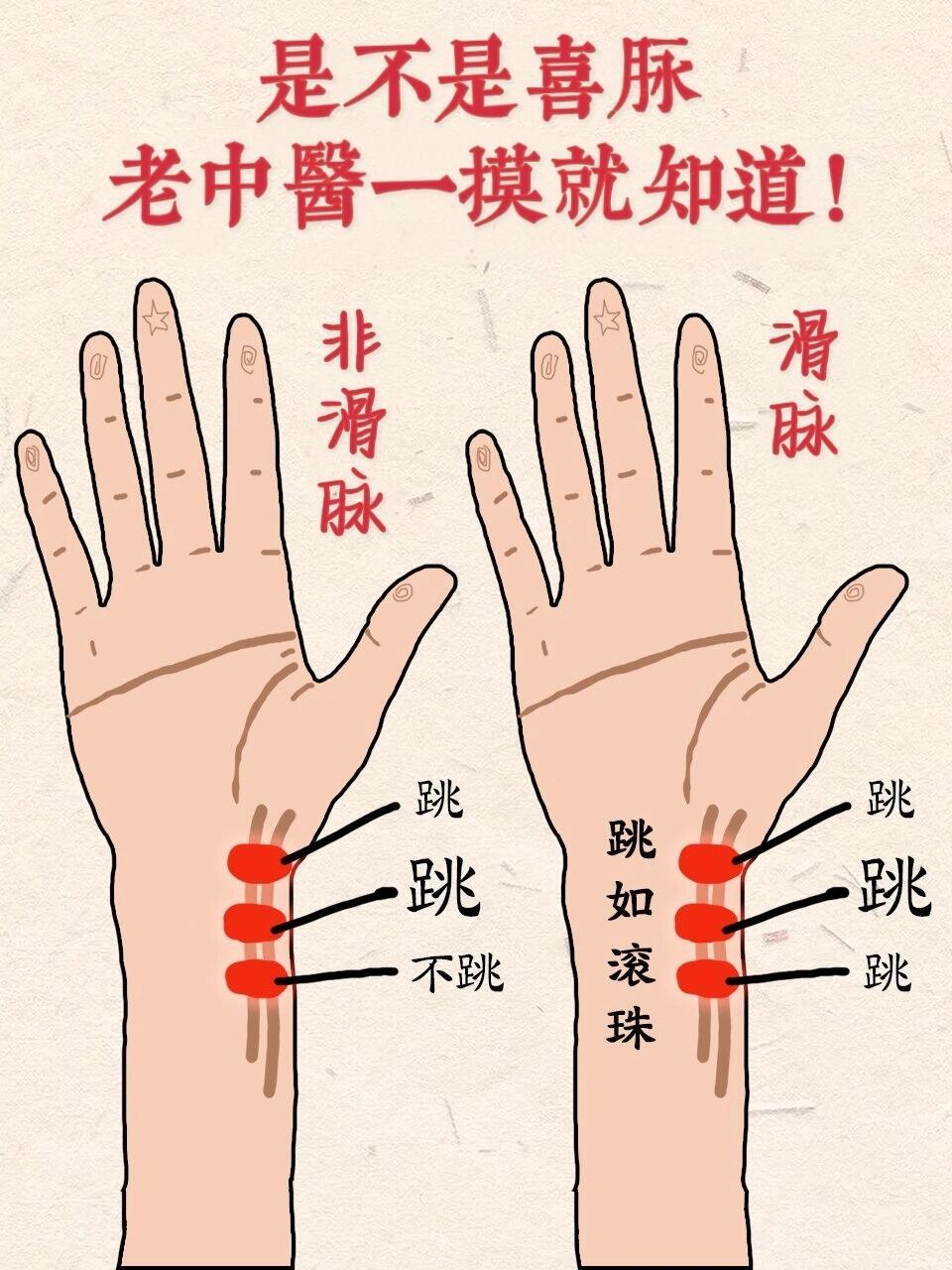 喜脉,老中医一摸就知道